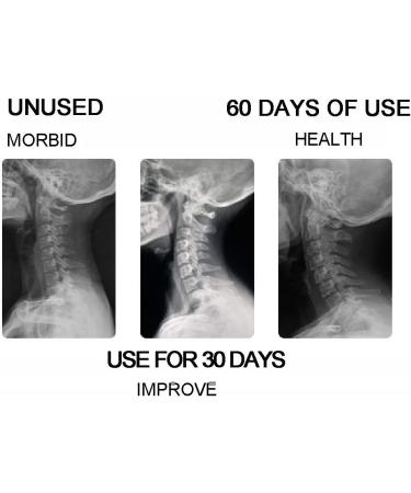 Buy Inflatable Neck Traction Device - Adjustable Support for Improved Spine & Cervical Alignment - Buy Online on GoSupps.com