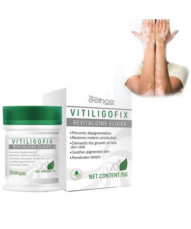 Vitiligo Fix Revitalize Elixir Vitiligo Treatment Cream Natural White Spot Remover Treat Vitiligo Soothing Cream Leukoplakia Relief for Reduce White Spot (Color : 2PCS)