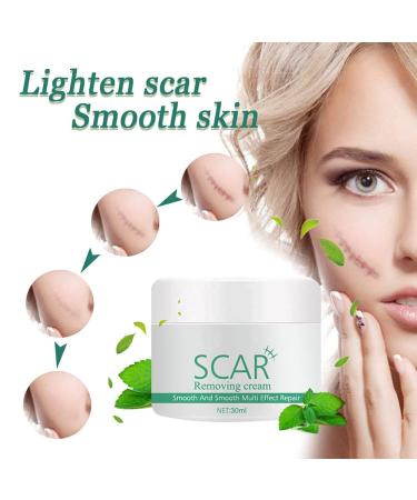 Hotiary Plant Scar Repair Cream - Acne & Stretch Mark Remover for Scars, Burns, Postoperative Skin - Men & Women - Buy Online on GoSupps.com