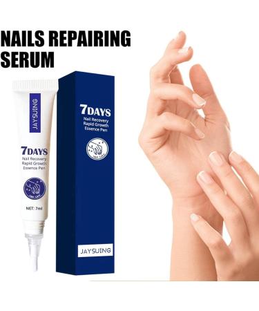 Nail Repair And Growth Essence Pen High-Strength Nail Growth Strengthening Essence 7-Day Nail Growth And Strengthening Essence Oil Thin Nail Hyperplasia Nail Serum Repair Essence 7ml - Buy Online on GoSupps.com