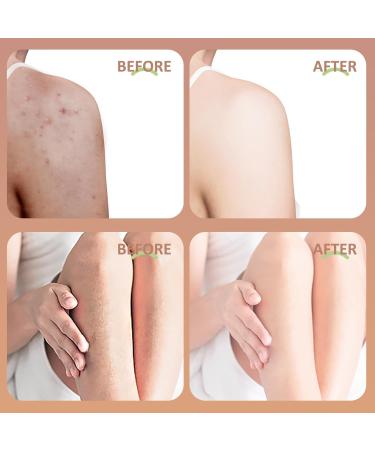 Coconut Oil Body Oil - Enriched with Vitamin E Moisturizing & Nourishing Formula 3.38 fl oz | International Shipping Available - Buy Online on GoSupps.com