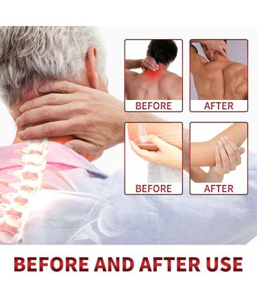 Shop Todahof Bee Venom Ointment - Relieve Joint Pain Fast (2PCS) | International Shipping Available - Buy Online on GoSupps.com