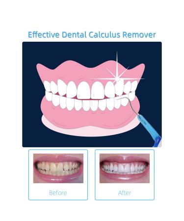 Tooth Stain Remover Tool - LED Oral Care Cleaning Kit for Family & Dentist Hygiene | Portable Dental Scraper & Mouth Mirror Set - Buy Online on GoSupps.com