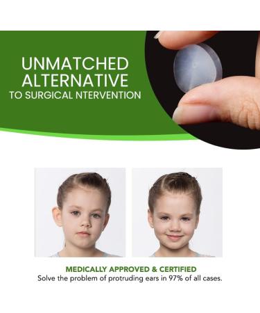 Cosmetic Ear Correctors for Children - 4 Pairs of Transparent Medical Grade Silicone Ear Tape for Non-Surgical Protruding Ear Correction | Safe for Toddlers & Kids - Buy Online on GoSupps.com