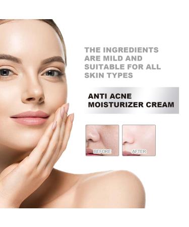 JOYVOIDX Hydrating Face Cream for Acne-Prone Skin with Niacinamide Hyaluronic Acid and Vitamin E Daily Moisturizer to Soothe Redness & Improve Skin Texture 50ml - Buy Online on GoSupps.com