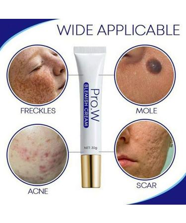 Pro.W Flaw Cream - Non-Irritating Acne Spot Treatment for Face | Anti-Macule Scar Freckles & Dark Spots Repair - Buy Online on GoSupps.com