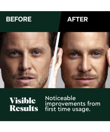 Wolf Project Under Eye Mask with Caffeine, Vitamin C, Peptides - Reduce Dark Circles, Puffiness, Wrinkles - 5 Pairs - Buy Online on GoSupps.com