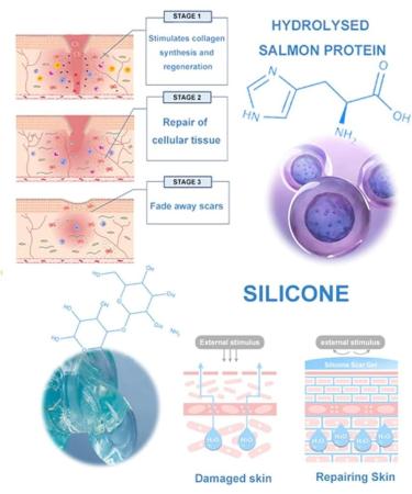 Finxenow ASMOXA Silicone Scar Gel - Effective C-Section & Stretch Mark Scar Remover - 3PCS - Buy Online on GoSupps.com