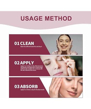 Eye Stye Remover for Fast Relief - Gentle Treatment for Styes  Chalazion  and Blepharitis - Buy Online on GoSupps.com