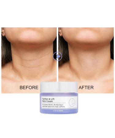 Neck Firming Cream - Anti-Aging Tightening & Lifting Treatment | Reduce Wrinkles & Improve Skin Firmness - Buy Online on GoSupps.com