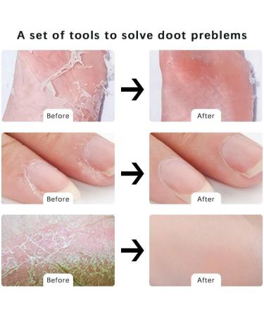 20-in-1 Professional Pedicure Foot Care Set | Stainless Steel Corn & Callus Remover | Best Foot Care Solutions - Buy Online on GoSupps.com