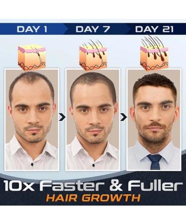 2Pcs Roll-On Massager Hair Growth Essence Set | Anti-Hair Loss Liquid for Men & Women | Fast Hair Regrowth Solution - Buy Online on GoSupps.com