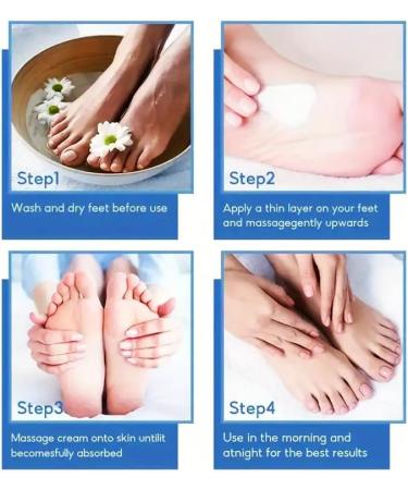 Urea Cream 45% Urea Foot Cream Foot Cream for Cracked Heels and Dry Skin Athletes Foot Cream Cracked Heel Repair Cream Cracked Heel Repair Cream for Feet and Hand - Buy Online on GoSupps.com