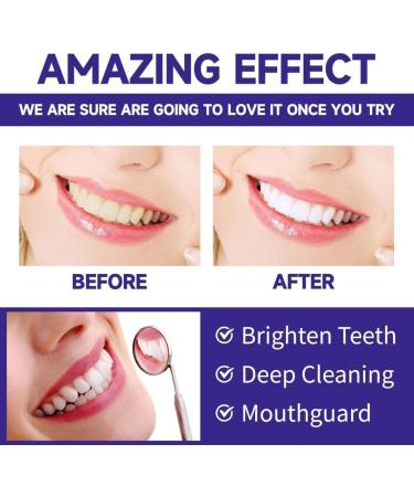 3 Days Teeth Whitening Powder Kit - Mint Flavors for Fresh Breath & Effective Cleaning (2PCs) | International Shipping Available - Buy Online on GoSupps.com