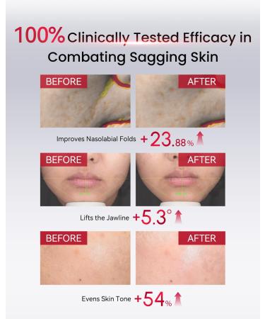 AMIRO PDRN Face Serum High-Potency Salmon DNA Ampoule with Nano Liposome Technology, Skin Firming & Hydrating Essence Must Be Used with AMIRO Microcurrent Facial Device 0.04 fl.oz x 30 - Buy Online on GoSupps.com