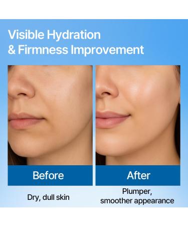 KLALAB Hyaluron Peptide Ampoule I Hyaluronate Coplex Serum 3.38 FL OZ. - Buy Online on GoSupps.com