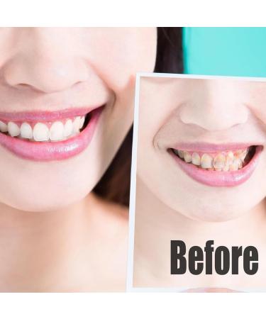 Tooth Sandpaper Polishing Strips - 3 Dental Grinding Rolls 6m 20 m 4mm Width | Brighten & Polish Teeth Interdentally - Buy Online on GoSupps.com