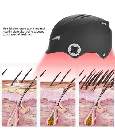 Anti Hair Loss Helmet Device - 650nm LED Hair Growth Cap for Men & Women | Stimulates Hair Follicles & Increases Hair Volume | FDA Certified - Buy Online on GoSupps.com