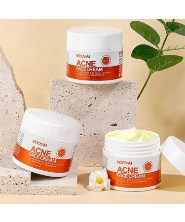 Acne Spot Treatment Cream for Acne 100g AHA BHA Lactic Acid & Zinc Scar Pimple Cream for Face Anti-Blemish Care  - Buy Online on GoSupps.com