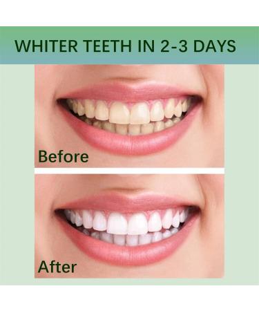 Elunara Teeth Whitening Strips | 5d White Teeth Whitening Strips | Elunara Teeth Strips Whitener Strips Effective Teeth Reduced Sensitivity White Strips Teeth Whitener Kits Tooth Whitening Kits (2) - Buy Online on GoSupps.com