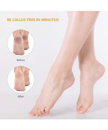 ERGOfoot 3 PCS Professional Foot Rasp Set for Wet/Dry Feet - Callus Remover & Pedicure Tool with Surgical Grade Stainless Steel File - Buy Online on GoSupps.com