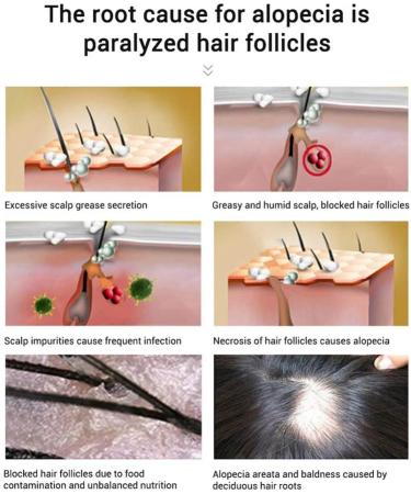 MKKENLEY Magic Hair Growth Tonic with Ginseng for Fast Hair Growth | Best Treatment for Men and Women with Baldness | Nourishing Scalp and Anti-Hair Loss Formula for Hair Regrowth - Buy Online on GoSupps.com