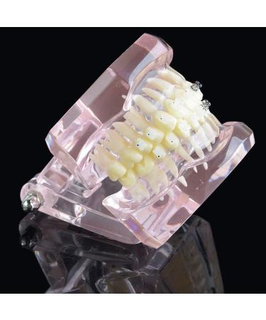 LBYLYH Orthodontic Demonstration Model - Teeth Teaching Tools with Metal & Ceramic Support for Effective Dental Treatment - Buy Online on GoSupps.com