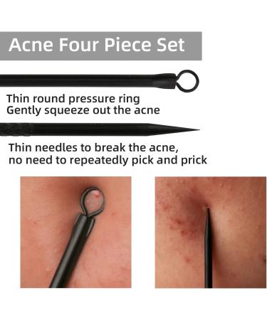 Duduer Blackhead Remover Pimple Popper Tool Kit for Acne Extraction on Nose and Face - Professional Comedone Extractor for Whitehead Removal - Buy Online on GoSupps.com