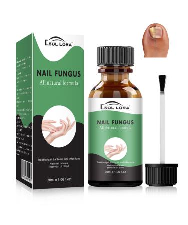 Fungal Nail Treatment - Extra Strong Nail Fungus Treatment for Toenail and Fingernail - Anti fungus Nail Repair and Strengthen Fix & Renew Damaged Broken Nails Restoring Healthy Nails-30ml