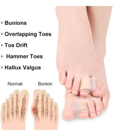 Toe Spreader & Bale Toe Corrector - Soft Gel Overlapping Toe Relief (2 Pieces) - Comfortable Pinky Toe Solution - Buy Online on GoSupps.com