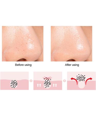 Silicone Nose & Lip Cleansing Brush - Double Sided Exfoliating Facial Brush for Blackhead Removal, Lip Scrubs & Moisturizing - Yellow - Buy Online on GoSupps.com