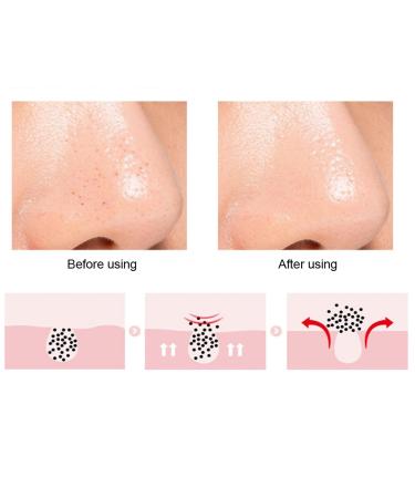 Silicone Nose & Lip Cleansing Brush Set - Double Sided Facial Brush for Blackhead Removal and Exfoliation - Lip Scrub Exfoliator & Moisturizer - Purple - Buy Online on GoSupps.com