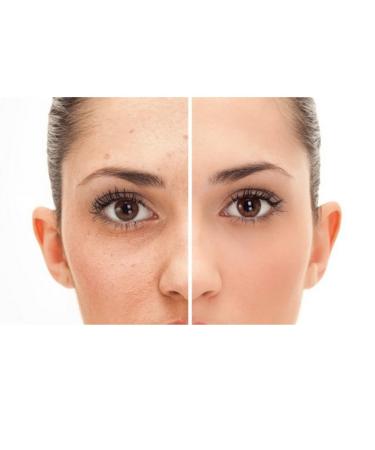 LaaBelleGlow Perfect Radiant Skin Serum Anti-Aging Treatment for Wrinkles and Dark Spots 2.03 fl oz - Buy Online on GoSupps.com