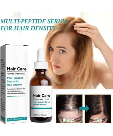 Hair Growth Serum Serum For Hair Density Hair Growth Oil Serum Anti Hair Loss Essence Hair Loss &Hair Thinning Treatment Hair Oil For Thinning Balding Fuller And Faster Growing Hair 60ml - Buy Online on GoSupps.com