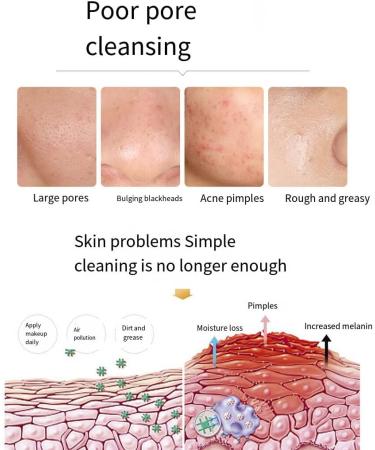 siduytin 5 Pieces for Grease Removal Facial Cover Portable Natural Ingredient Oil Balance Pore Cleaning Covers Ladies Skin Care - Buy Online on GoSupps.com