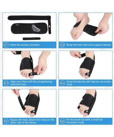 Doact Bunion Corrector Rail | 3D Printed Hallux Valgus Orthosis for Men & Women | Overlapping Toe Solution - Buy Online on GoSupps.com