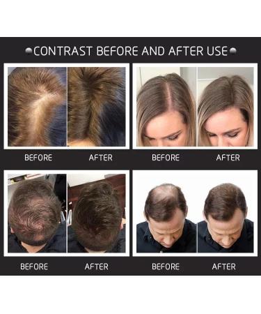 Hair Fibres Black Hair Building Fibres Professional Quality Hair Fibers Powder for Thinning Hair Thickener Natural Hair Fiber Instantly Conceals Hair Loss for Bald Spots & Thinning Hair(Black) - Buy Online on GoSupps.com