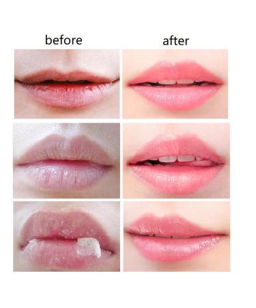 4 PCS Bee Lip Balm Honey Pot Propolis Lip Mask Moisturizing Moisture Nourishing Dry & Chapped Care and Reduces Lines Exfoliating (Honey) Honey 4 pcs - Buy Online on GoSupps.com