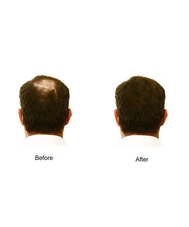 Hair Enhancer Spray for Fine/Thinning Hair - 5 oz - Beige Blonde - Buy Online on GoSupps.com
