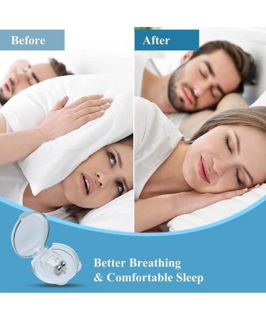 MAPPERZ Snore Free Nose Clip - Stop Snoring with Silicone Magnetic Anti Snoring Device - Buy Online on GoSupps.com