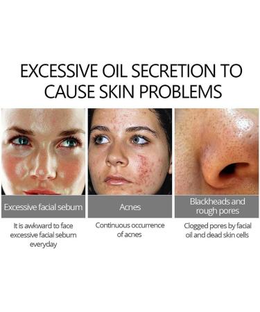 20% Azelaic Acid Serum Cream Azelaic Acid Cream Face Serum Skin Care Beauty with Niacinamide & Vitamin C Reduces Blackheads Acne Rosacea - Buy Online on GoSupps.com