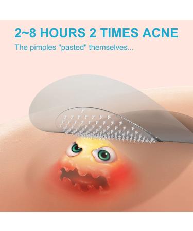 Jonov Acne Pimple Patch - Fast Acting Hydrocolloid Pimple Patches for Night - 18 Blemish Cover Stickers for Face - Buy Online on GoSupps.com