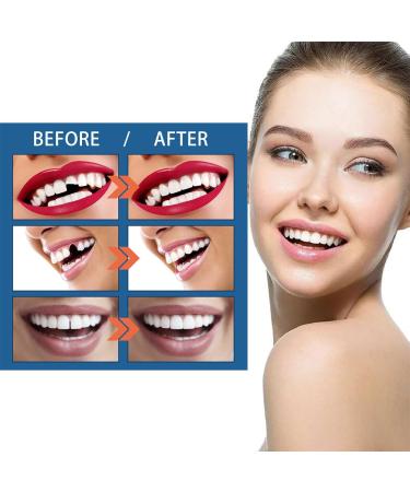 Buy Temporary Dentures & Tooth Repair Set | Instant Cosmetic Solutions for Perfect Smile - 20ML - Buy Online on GoSupps.com