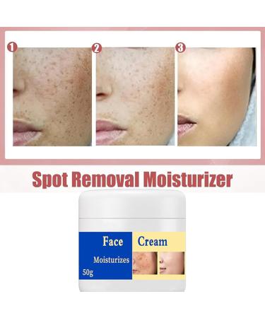 Melasma Treatment for Face Removes Facial Melasma Dark Spots Spot Cream Hyperpigmentation Treatment Sun Spots and Melasma Freckle Remover Remove Dark Spots Pigmentation Removal Cream for Face - Buy Online on GoSupps.com