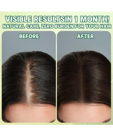 Teegxddy 1 piece Nature triangular shampoo bar plantbased solid shampoo bar gentle cleansing and nourishing care for women and men strengthens smooth hair - Buy Online on GoSupps.com