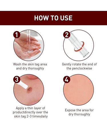 Wipe Off Tags and Mole Remover Skin Tag Remover & Mole Remover for Face Armpit Flesh Neck - Buy Online on GoSupps.com