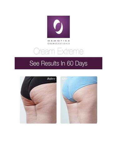 Osmotics Cream Extreme Intensive Repair Deep Moisture Barrier Cream for Dry Sensitive & Damaged Skin Restores Hydration Soothes Irritation & Strengthens Skin Barrier - Buy Online on GoSupps.com