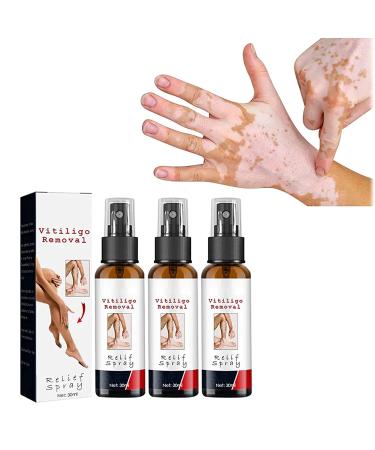 DUBUSH Vitiligo Soothing Spray Vitiligo Skin Repair Spray 3pcs