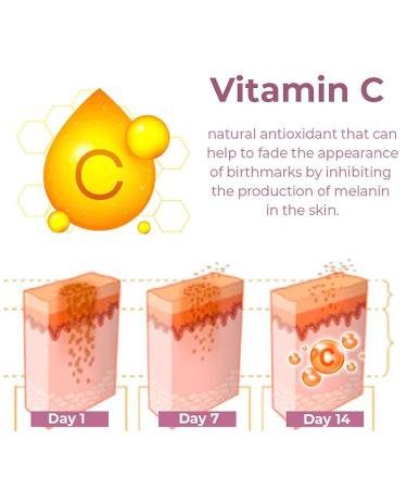 GFOUK German Birthmark Removal Oil & Cream - Dark Spot Remover for Face Acanthosis Nigricans Therapy Oil (2PCs) - Buy Online on GoSupps.com