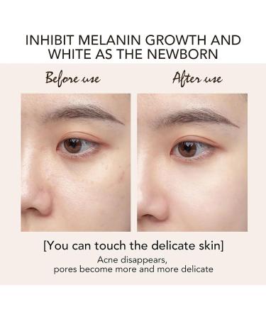 AILKE BOOST LUSTER AILKE Kojic Acid Whitening face cream dark spot removal day and night face cream deep clean spots radiant skin suitable for women and men 50 g pack of 1 1 copy - Buy Online on GoSupps.com